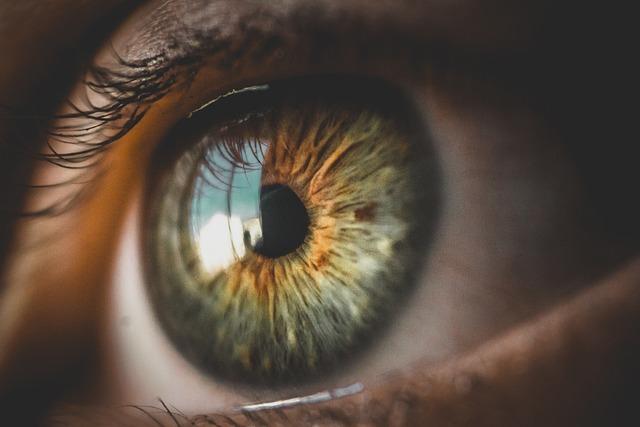 How to reduce under-eye puffiness naturally