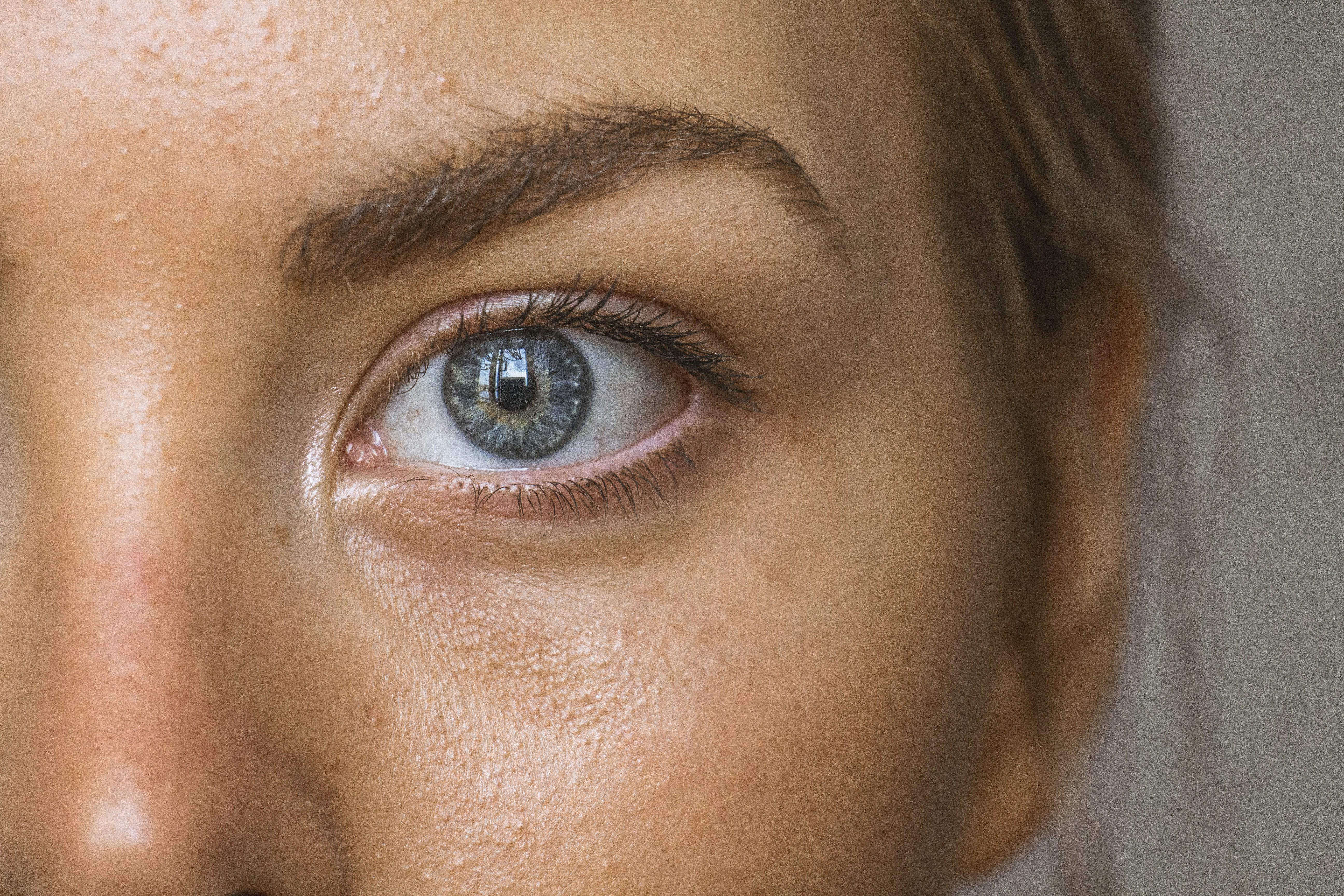 How to manage redness and irritation in sensitive skin